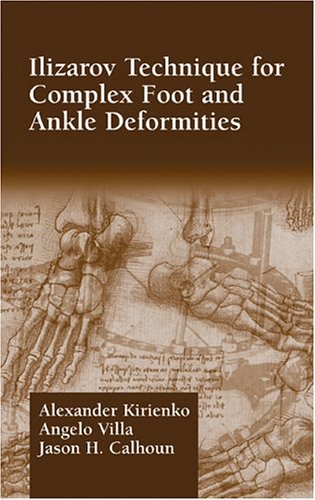 Alexander Kirienko Ilizarov Technique For Complex Foot And Ankle Deformities 1st Edition Alexander Kirienko