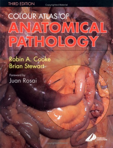 Colour Atlas Of Anatomical Pathology 3rd Edition Robin A Cooke