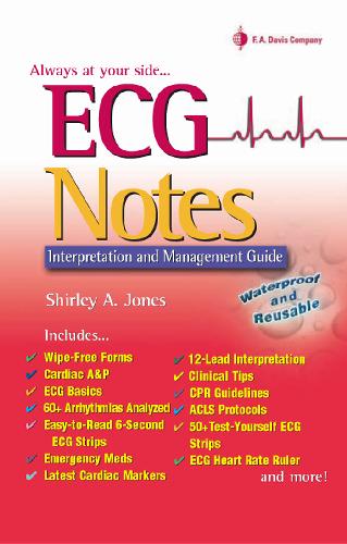 Ecg Notes Interpretation And Management Guide Shirley A Jones