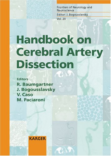 Handbook On Cerebral Artery Dissection 1st Edition R W Baumgartner