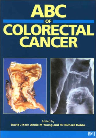 Fd Richard Hobbs Abc Of Colorectal Cancer 1st Edition David Kerr