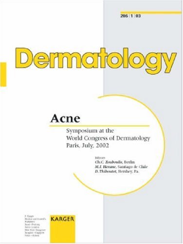 Acne For Dummies 1st Edition C C Zouboulis Maria Isabel Herane