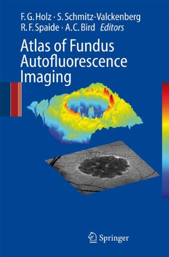 Atlas Of Fundus Autofluorescence Imaging 1st Edition Frank G Holz