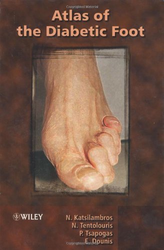 Atlas Of The Diabetic Foot 1st Edition N Katsilambros N Tentolouris