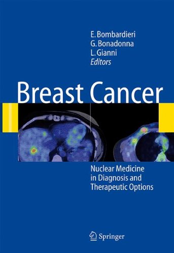 Breast Cancer Nuclear Medicine In Diagnosis And Therapeutic Options 1st Edition Emilio Bombardieri