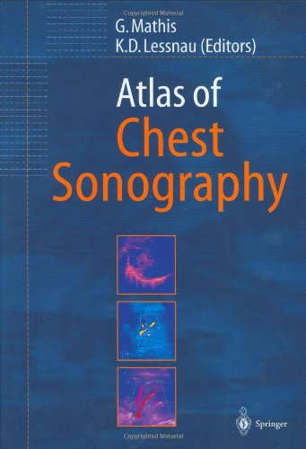 Atlas Of Chest Sonography 1st Edition Gebhard Mathis Klaus D Lessnau