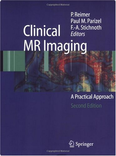 Clinical Functional Mri Presurgical Functional Neuroimaging P Reimer