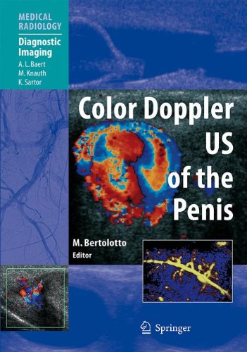 Color Doppler Us Of The Penis 1st Edition Michele Bertolotto