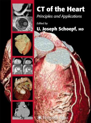 Ct Of The Heart Principles And Applications 1st Edition U Joseph Schoepf