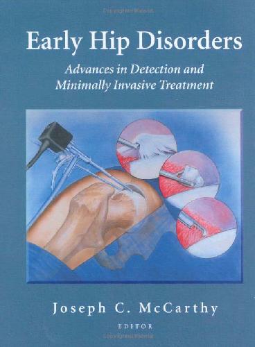 Early Hip Disorders 1st Edition Joseph C Mccarthy