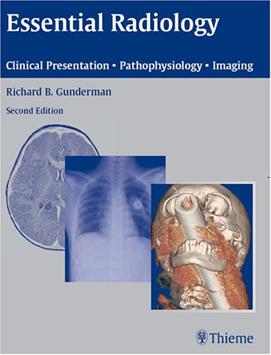 Essential Radiology Clinical Presentation Pathophysiology Imaging 2nd Edition Richard Gunderman