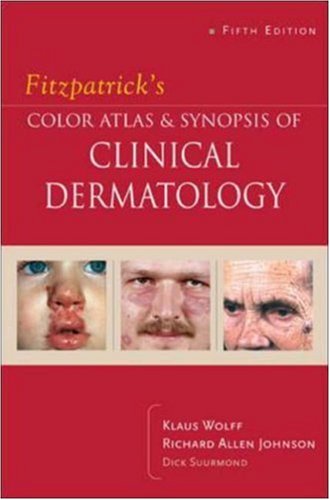 Fitzpatricks Color Atlas Synopsis Of Clinical Dermatology 5th Edition Klaus Wolff