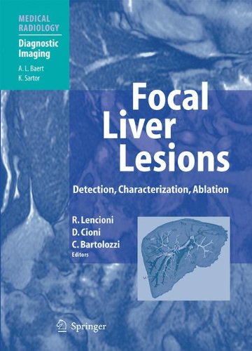 Focal Liver Lesions Detection Characterization Ablation 1st Edition Riccardo Lencioni