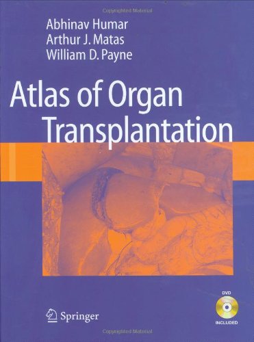 Atlas Of Organ Transplantation 1st Edition Abhinav Humar Arthur J Matas