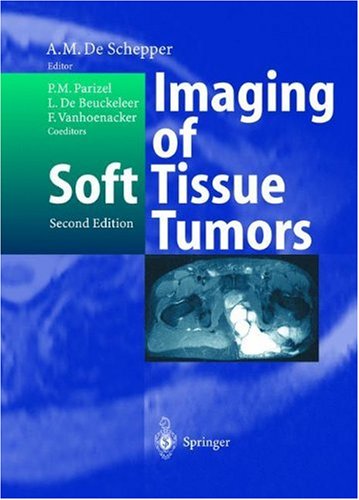 Imaging Of Soft Tissue Tumors 2nd Pm Parizel Arthur M De Schepper