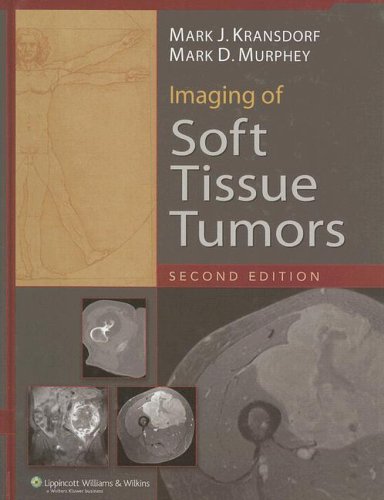 Imaging Of Soft Tissue Tumors Second Mark J Kransdorf Mark D Murphey