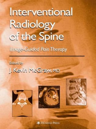 Interventional Radiology In Pain Treatment 1st Edition J Kevin Mcgraw