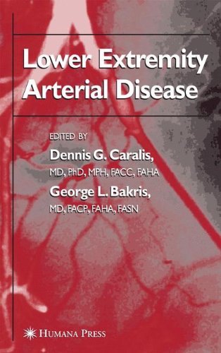 Lower Extremity Arterial Disease 1st Edition Dennis G Caralis