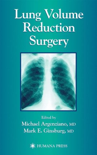 Lung Volume Reduction Surgery 1st Edition Michael Argenziano
