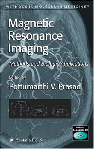Magnetic Resonance Imaging In Stroke 1st Edition Stephen Davis