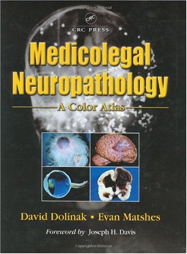 Medical Therapy Of Breast Cancer 1st Edition David Dolinak Evan W Matshes