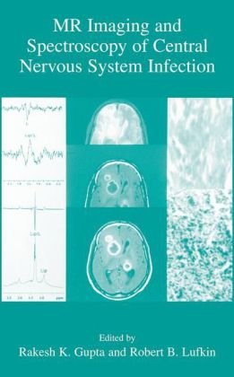 Mr Imaging And Spectroscopy Of Central Nervous System Infection 1st Rakesh K Gupta