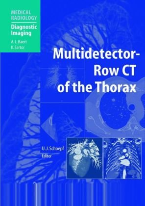 Multidetectorrow Ct Angiography U Joseph Schoepf Mf Reiser