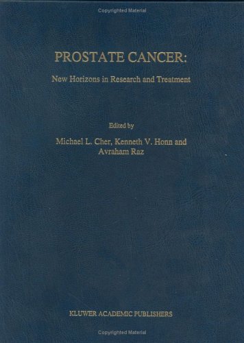 Prostate Cancer New Horizons In Research And Treatment 1st Edition Michael L Cher