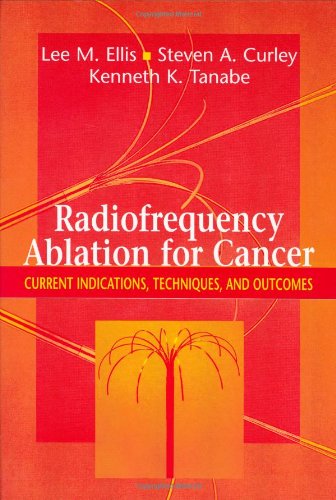 Radiofrequency Ablation For Cancer Current Indications Techniques And Outcomes 1st Edition Lee M Ellis