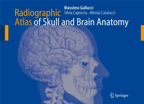 Radiographic Atlas Of Skull And Brain Anatomy 1st Edition Massimo Gallucci