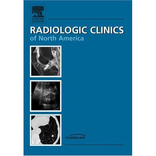 Radiologic Clinics Of North America Advances In Renal Imaging