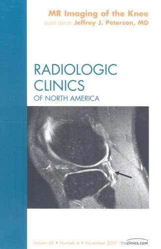 Radiologic Clinics Of North America Mr Imaging Of The Knee 1st Edition Jeffrey J Peterson Md