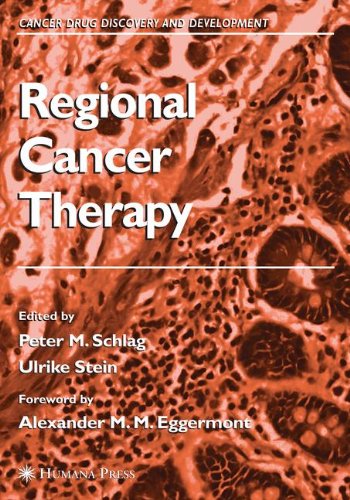 Regional Cancer Therapy Cancer Drug Discovery And Development 1st Edition Peter M Schlag