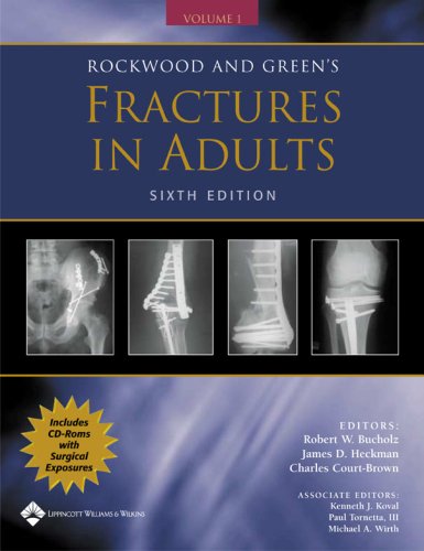 Rockwood And Greens Fractures In Adults Sixth Edition Robert W Bucholz