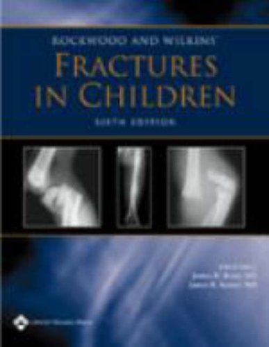 Rockwood And Wilkins Fractures In Children Sixth James H Beaty