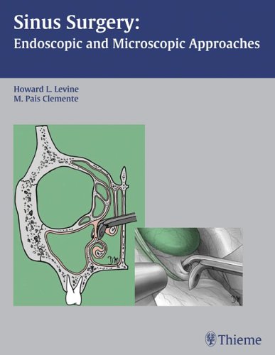 Sinus Surgery Endoscopic And Microscopic Approaches 1st Edition Howard Levine