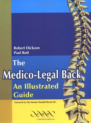 The Medicolegal Back An Illustrated Guide 1st Edition Robert A Dickson