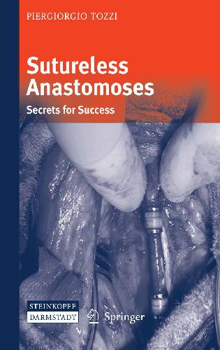 Sutureless Anastomoses Secrets For Success P Tozzi