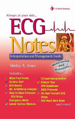 Ecg Notes Interpretation And Managment Guide Shirley A Jones