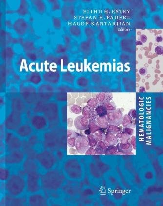 Hematologic Malignancies Acute Leukemias Elihu H Estey Sh Faderl