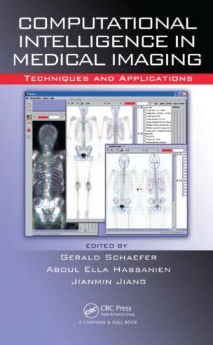 Computational Intelligence In Medical Imaging Techniques And Applications G Schaefer