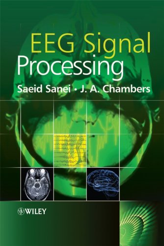 Eeg Signal Processing Saeid Sanei J A Chambers