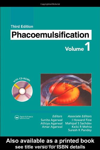 Phacoemulsification 3rd Sunita Agarwal Amar Agarwal Athiya Agarwal