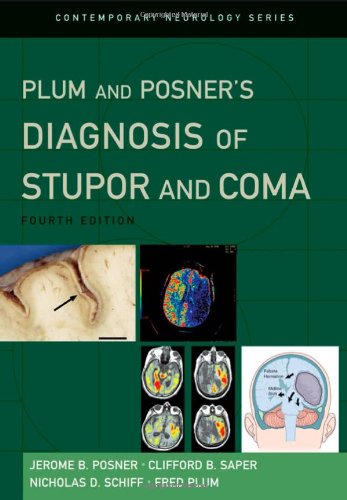 Plum And Posners Diagnosis Of Stupor And Coma 4th Ed Jerome B Posner Md