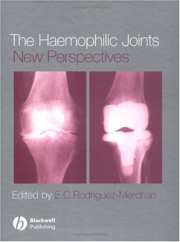 The Haemophilic Joints New Perspectives 1st Edition E C Rodriguezmerchan Md