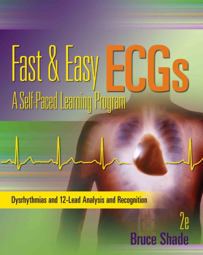 Fast Easy Ecgs A Selfpaced Learning Program 2nd Ed Shade