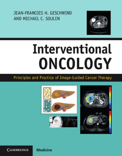 Interventional Oncology Principles And Practice Of Imageguided Cancer Therapy 2nd Edition Jeanfrancois H Geschwind