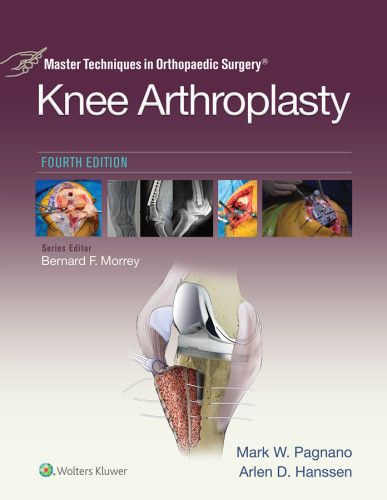 Master Techniques In Orthopedic Surgery Knee Arthroplasty 4th Edition Mark W Pagnano