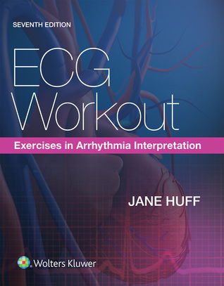 Ecg Workout Exercises In Arrhythmia Interpretation Paperback Jane Huff