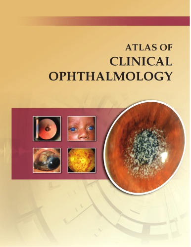 Atlas Of Clinical Ophthalmology 2nd Edition Samar K Basak